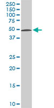 STK38 monoclonal antibody (M04), clone 2F3