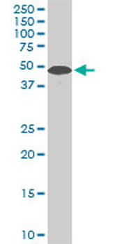 STK38 monoclonal antibody (M04), clone 2F3