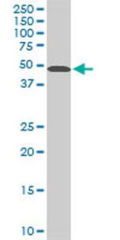 STK38 monoclonal antibody (M04), clone 2F3