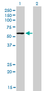 STK38 monoclonal antibody (M04), clone 2F3