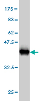 STK38 monoclonal antibody (M04), clone 2F3