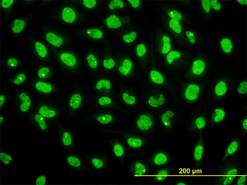 STK38 monoclonal antibody (M01), clone 2G8-1F3