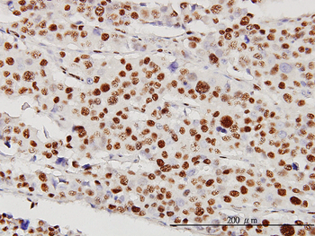 STK38 monoclonal antibody (M01), clone 2G8-1F3