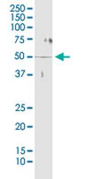 STK38 monoclonal antibody (M01), clone 2G8-1F3