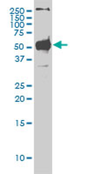 STK38 monoclonal antibody (M01), clone 2G8-1F3