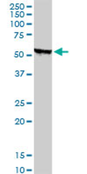 STK38 monoclonal antibody (M01), clone 2G8-1F3