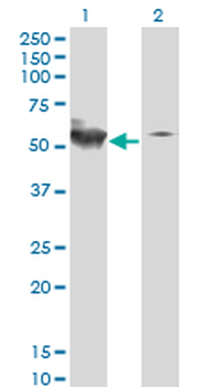 STK38 monoclonal antibody (M01), clone 2G8-1F3