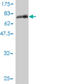 STK38 monoclonal antibody (M01), clone 2G8-1F3