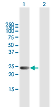 LYPLA2 purified MaxPab mouse polyclonal antibody (B01P)