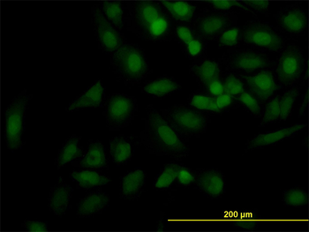 KIF2C monoclonal antibody (M01), clone 1G2