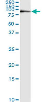 KIF2C monoclonal antibody (M01), clone 1G2