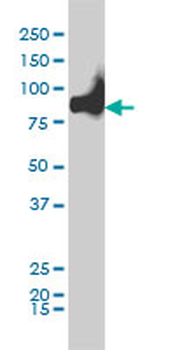 KIF2C monoclonal antibody (M01), clone 1G2