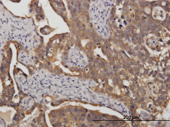 STIP1 monoclonal antibody (M35), clone 2E11