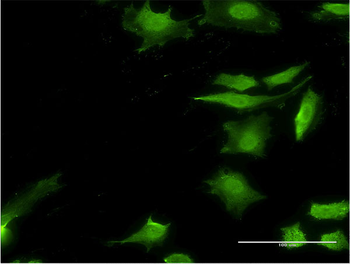 STIP1 monoclonal antibody (M33), clone 2E1