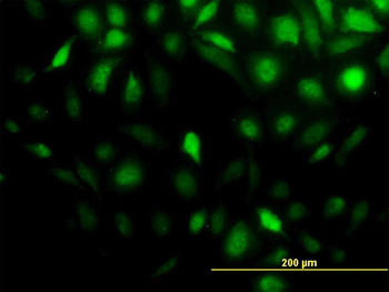 STIP1 monoclonal antibody (M01), clone 4B6