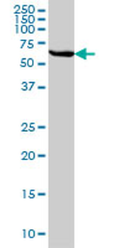 STIP1 monoclonal antibody (M01), clone 4B6