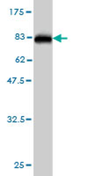 STIP1 monoclonal antibody (M01), clone 4B6