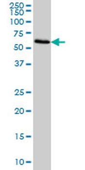 FGL2 monoclonal antibody (M01), clone 6D9