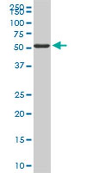 FGL2 monoclonal antibody (M01), clone 6D9