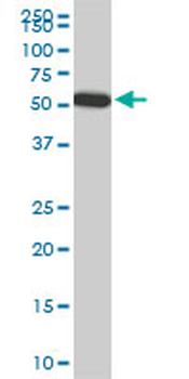 FGL2 monoclonal antibody (M01), clone 6D9