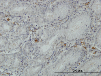 FGL2 monoclonal antibody (M01), clone 6D9