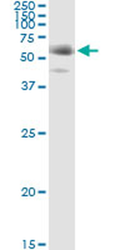 FGL2 monoclonal antibody (M01), clone 6D9