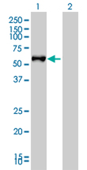 FGL2 monoclonal antibody (M01), clone 6D9