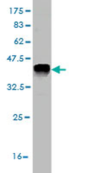 FGL2 monoclonal antibody (M01), clone 6D9