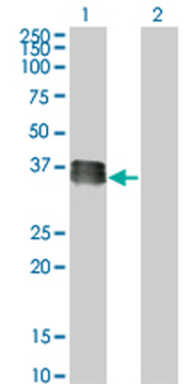 SIX2 monoclonal antibody (M01), clone 3D7