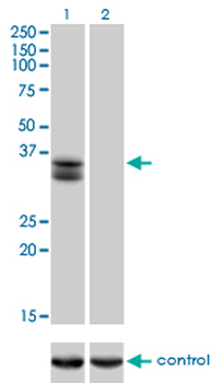 SIX2 monoclonal antibody (M01), clone 3D7