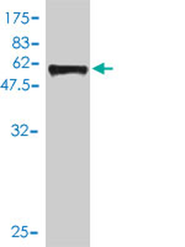 SIX2 monoclonal antibody (M01), clone 3D7