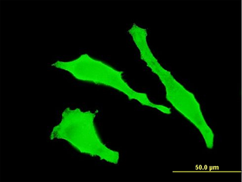 TGOLN2 monoclonal antibody (M02), clone 2F11