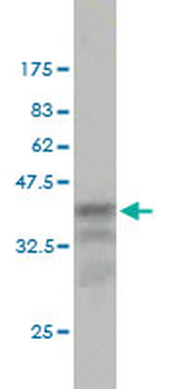 CCT7 monoclonal antibody (M01), clone 1D6