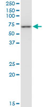 CCT7 monoclonal antibody (M01), clone 1D6