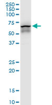 CCT7 monoclonal antibody (M01), clone 1D6