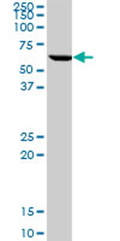 CCT7 monoclonal antibody (M01), clone 1D6