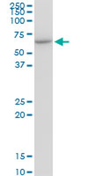 CCT7 monoclonal antibody (M01), clone 1D6