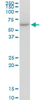 CCT7 monoclonal antibody (M01), clone 1D6