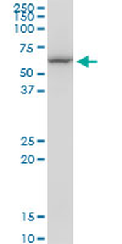 CCT7 monoclonal antibody (M01), clone 1D6