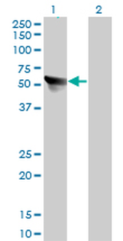 CCT7 monoclonal antibody (M01), clone 1D6