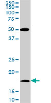 BATF monoclonal antibody (M01), clone 8A12