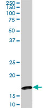 BATF monoclonal antibody (M01), clone 8A12