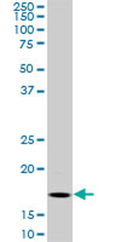 BATF monoclonal antibody (M01), clone 8A12