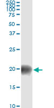 BATF monoclonal antibody (M01), clone 8A12