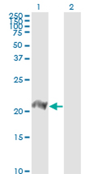 BATF monoclonal antibody (M01), clone 8A12