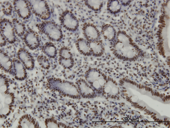 TRIM28 monoclonal antibody (M01), clone 4E6