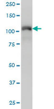 TRIM28 monoclonal antibody (M01), clone 4E6