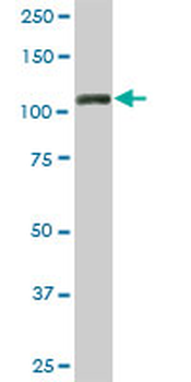 TRIM28 monoclonal antibody (M01), clone 4E6