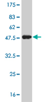 TRIM28 monoclonal antibody (M01), clone 4E6