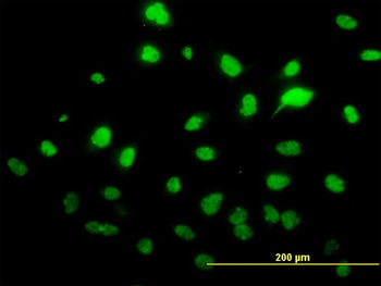 SAE1 monoclonal antibody (M01), clone 1G4-1G5